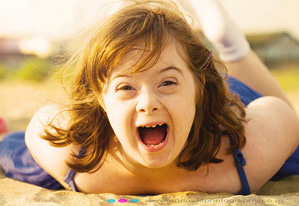 Down-syndrome-girl-small